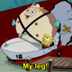 Illustration for article titled My thigh is atrophied